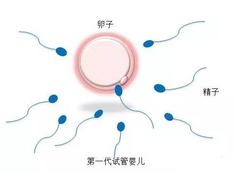女同伴侣借卵代怀